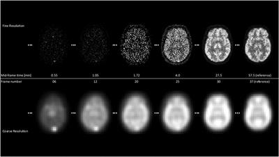 A scale space theory based motion correction approach for dynamic PET brain imaging studies